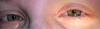 what_i_been_telling_you_guys_about...my_creepyeyes